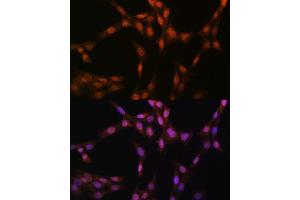 Immunofluorescence analysis of NIH-3T3 cells using Glutathione Synthetase (GSS) (GSS) Rabbit mAb (ABIN7267452) at dilution of 1:100 (40x lens). (Glutathione Synthetase Antikörper)