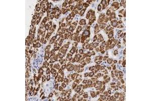 Immunohistochemical staining of human liver with OTC polyclonal antibody  shows cytoplasmic positivity in hepatocytes. (OTC Antikörper  (AA 172-299))