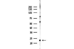 anti-Transmembrane BAX Inhibitor Motif Containing 4 (TMBIM4) (N-Term) antibody