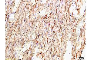 Immunohistochemistry (IHC) image for anti-Angiotensin II Receptor, Type 1 (AGTR1) antibody (ABIN671121)