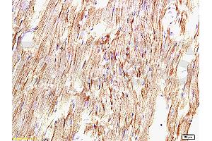 Formalin-fixed and paraffin embedded rat myocardium tissue labeled with Anti-AT1R/AGTR1 Polyclonal Antibody, Unconjugated (ABIN671121) at 1:200, followed by conjugation to the secondary antibody and DAB staining (Angiotensin II Type-1 Receptor Antikörper)