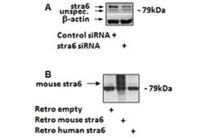 Image no. 1 for anti-Stimulated By Retinoic Acid 6 (STRA6) (C-Term) antibody (ABIN374801) (STRA6 Antikörper  (C-Term))