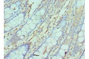 Immunohistochemistry of paraffin-embedded human colon tissue using ABIN7161752 at dilution of 1:100 (NCBP2 Antikörper  (AA 1-156))
