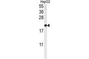 Western Blotting (WB) image for anti-SFT2 Domain Containing 3 (SFT2D3) antibody (ABIN3002289) (SFT2D3 Antikörper)
