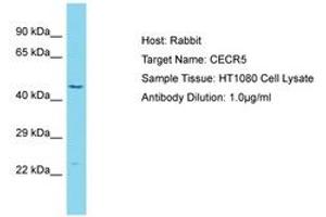Image no. 1 for anti-Cat Eye Syndrome Chromosome Region, Candidate 5 (CECR5) (AA 353-402) antibody (ABIN6750600) (CECR5 Antikörper  (AA 353-402))