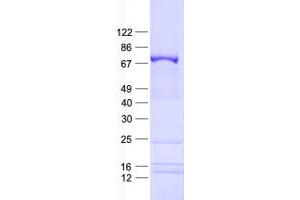 Validation with Western Blot (KIAA0020 Protein (His tag))