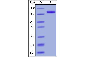 SDS-PAGE (SDS) image for Interleukin 6 Receptor, alpha (IL6RA) (AA 20-365) (Active) protein (Fc Tag) (ABIN6388246)