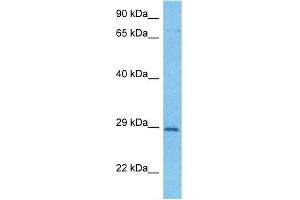 Western Blotting (WB) image for anti-F-Box and WD Repeat Domain Containing 7 (FBXW7) (C-Term) antibody (ABIN2782955)