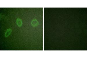 Peptide - +Immunofluorescence analysis of HuvEc cells, using ErbB2 antibody. (ErbB2/Her2 Antikörper  (Internal Region))