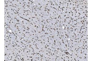 IHC analysis of DBC-1/CCAR2 using anti-DBC-1/CCAR2 antibody (ABIN7602235).