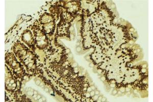 ABIN6277777 at 1/100 staining Mouse colon tissue by IHC-P. (LEF1 Antikörper  (Internal Region))