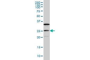 DCAKD monoclonal antibody (M02), clone 3E4 Western Blot analysis of DCAKD expression in MCF-7 . (DCAKD Antikörper  (AA 113-200))