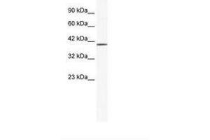 Image no. 1 for anti-Zinc Finger Protein 322A (ZNF322A) (AA 63-112) antibody (ABIN6735994) (ZNF322A Antikörper  (AA 63-112))