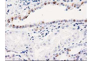 Immunohistochemical staining of paraffin-embedded Human Kidney tissue using anti-ITM2B mouse monoclonal antibody.