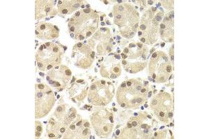 Immunohistochemistry of paraffin-embedded Human gastric using POU2F1 antibody at dilution of 1:100 (x400 lens). (POU2F1 Antikörper  (AA 15-290))