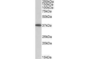 Western Blotting (WB) image for anti-Monoacylglycerol O-Acyltransferase 2 (MOGAT2) antibody (ABIN5903599) (MOGAT2 Antikörper)
