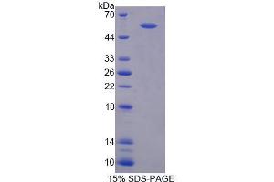SDS-PAGE (SDS) image for Regulator of G-Protein Signaling 6 (RGS6) (AA 1-472) protein (His tag) (ABIN4989982) (RGS6 Protein (AA 1-472) (His tag))