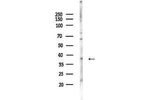 anti-Membrane-Associated Ring Finger (C3HC4) 9 (MARCH9) (N-Term) antibody