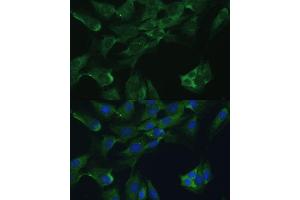 Immunofluorescence analysis of C6 cells using Adenosine Deaminase (Adenosine Deaminase (ADA)) antibody (ABIN3021281, ABIN3021282, ABIN3021283 and ABIN6214343) at dilution of 1:100.