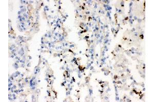 Anti- SFTP A1/2 Picoband antibody, IHC(P) IHC(P): Human Lung Cancer Tissue (SFTPA1/ 2 (AA 206-237), (C-Term) Antikörper)