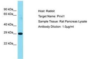 Image no. 1 for anti-Dorsal Root Ganglia Homeobox (DRGX) (AA 101-150) antibody (ABIN6750246) (DRGX Antikörper  (AA 101-150))