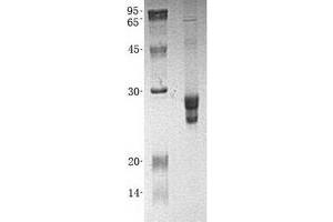 Validation with Western Blot (GSTZ1 Protein (Transcript Variant 3) (His tag))