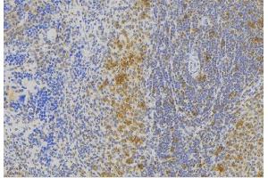ABIN6273007 at 1/100 staining Human lymph node tissue by IHC-P. (Melanophilin Antikörper  (C-Term))