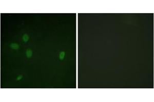 Immunofluorescent staining of NIH/3T3 cells reacted with TP53BP1 (phospho S25) polyclonal antibody  at 1:100-1:500 dilution. (TP53BP1 Antikörper  (pSer25))