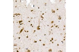 Immunohistochemistry of paraffin-embedded human brain using UB Rabbit mAb (ABIN7271128) at dilution of 1:50 (40x lens). (UBA52 Antikörper)