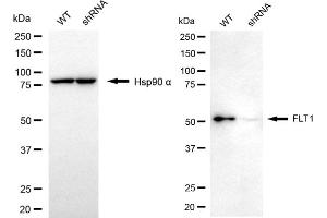 Western blotting analysis using FLT1 antibody (ABIN7798636). (FLT1 Antikörper)