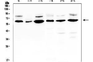 Western blot analysis of EGFL6 using anti-EGFL6 antibody (ABIN6719596).