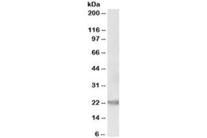 Western blot testing of human prostate lysate with IL-25 antibody at 0. (IL-25 Antikörper)