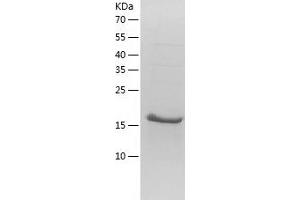 Western Blotting (WB) image for Myosin Regulatory Light Chain 2, Smooth Muscle Isoform (MYL9) (AA 1-172) protein (His tag) (ABIN7124068)