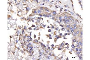 IHC analysis of DLST using anti-DLST antibody (ABIN7599412). (DLST Antikörper  (AA 1-453))