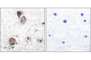 Immunohistochemistry (IHC) image for anti-V-Yes-1 Yamaguchi Sarcoma Viral Related Oncogene Homolog (LYN) (AA 463-512), (pTyr507) antibody (ABIN1531232)