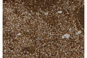 ABIN6265922 and ABIN6279898 at 1/100 staining Mouse spleen tissue by IHC-P. (USP31 Antikörper  (N-Term))