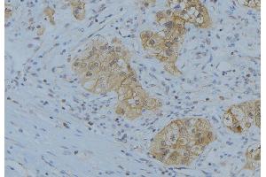 ABIN6266627 at 1/100 staining Human uterus tissue by IHC-P. (Prostate Specific Antigen Antikörper  (Internal Region))