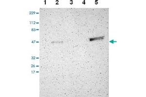 Western blot analysis of Lane 1: RT-4, Lane 2: U-251 MG, Lane 3: Human Plasma, Lane 4: Liver, Lane 5: Tonsil with TRAF1 polyclonal antibody . (TRAF1 Antikörper)