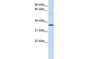 WB Suggested Anti-C16orf46 Antibody Titration: 0. (C16ORF46 Antikörper  (N-Term))