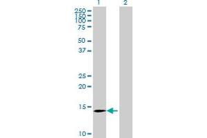 Western Blot analysis of MGC33839 expression in transfected 293T cell line by MGC33839 MaxPab polyclonal antibody. (CLDND2 Antikörper  (AA 1-167))