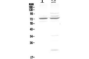 Western Blotting (WB) image for anti-Choroideremia (Rab Escort Protein 1) (CHM) (AA 193-380) antibody (ABIN5693178)