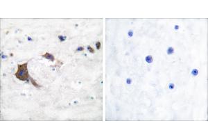 Peptide - +Immunohistochemical analysis of paraffin-embedded human brain tissue using ERAB antibody. (HSD17B10 Antikörper)
