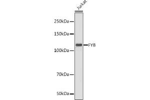 Western blot analysis of extracts of Jurkat cells, using FYB antibody (ABIN7267283) at 1:1000 dilution. (FYB Antikörper  (AA 678-829))