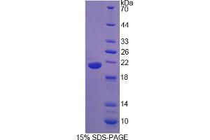 Image no. 1 for Urocortin 3 (UCN3) (AA 24-164) protein (His tag) (ABIN4989734)
