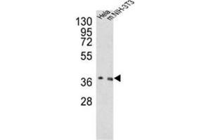 Western blot analysis of OGG1 Antibody (C-term) in Hela, NIH-3T3 cell line lysates (35ug/lane). (OGG1 Antikörper  (C-Term))