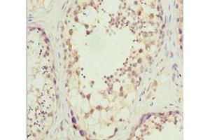 Immunohistochemistry of paraffin-embedded human testis tissue using ABIN7170027 at dilution of 1:100 (SLC9A6 Antikörper  (AA 510-669))