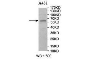 Western Blotting (WB) image for anti-Carnosine Dipeptidase 1 (Metallopeptidase M20 Family) (CNDP1) antibody (ABIN5907141) (CNDP1 Antikörper)