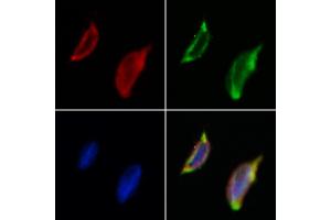 ABIN6261625 and ABIN6273045 staining Hela by IF/ICC.
