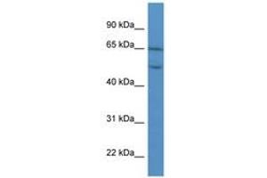 Image no. 1 for anti-Collagen, Type VIII, alpha 2 (COL8A2) (AA 469-518) antibody (ABIN6746741) (COL8a2 Antikörper  (AA 469-518))