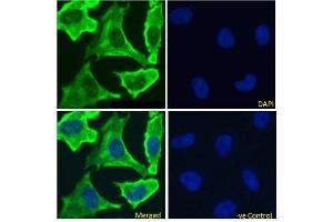 Immunofluoresence staining of fixed HeLa cells with anti-EGFR antibody 528. (Rekombinanter EGFR Antikörper)